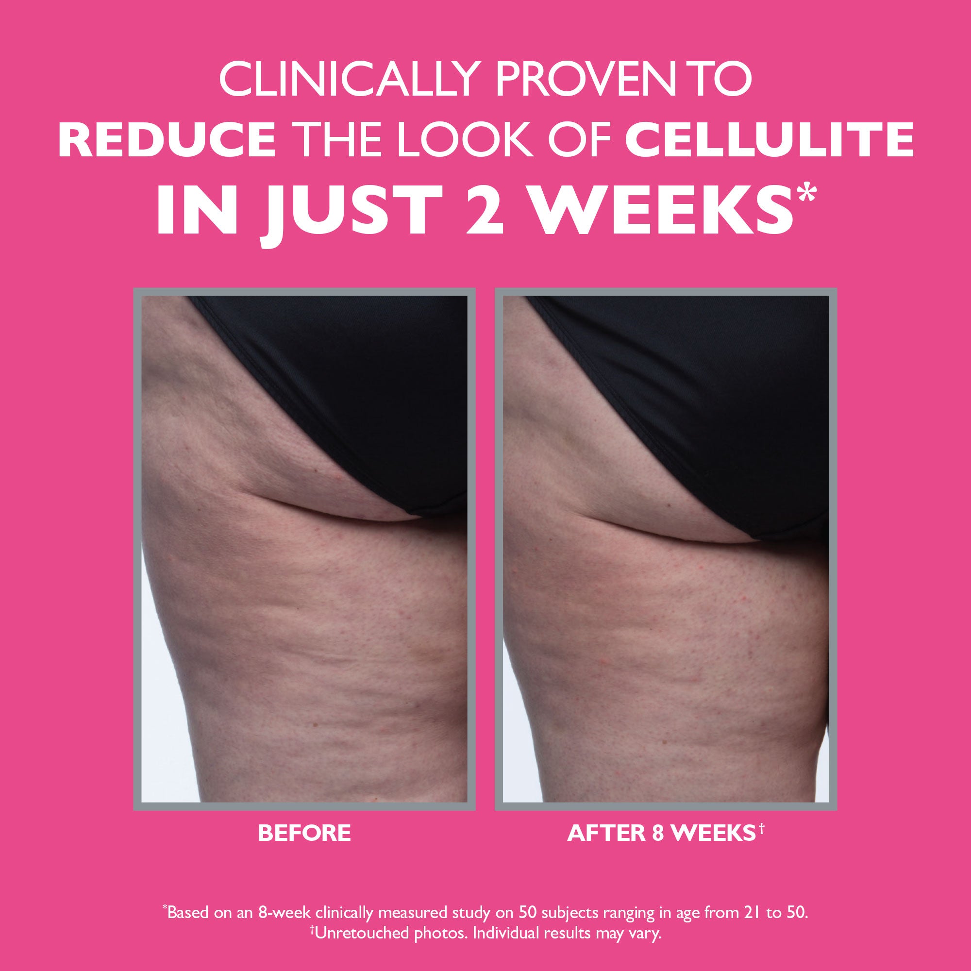 Peter Thomas Roth - FirmX Tight & Toned Cellulite Treatment image 8